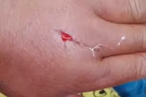 Un hombre fue atacado a machetazos