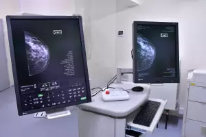 Salud avanza en una importante compra de equipamiento sanitario