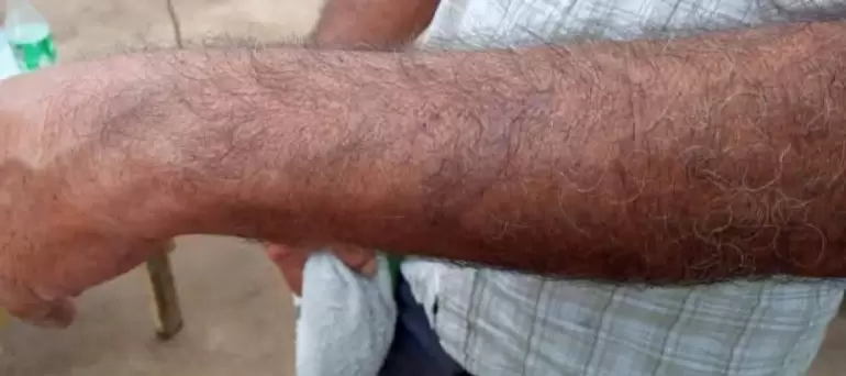 Rescatan a un trabajador que era golpeado por su jefe