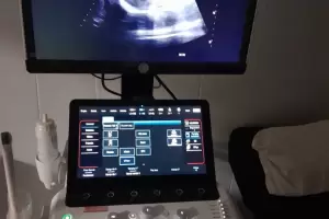 Instalaron nuevo ecgrafo en Andalgal