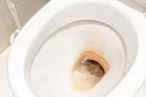 Cmo eliminar el sarro del inodoro: mtodos caseros y efectivos para mantener el bao impecable en Catamarca