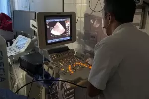 Primera ecocardiografa transesofgica en el San Juan