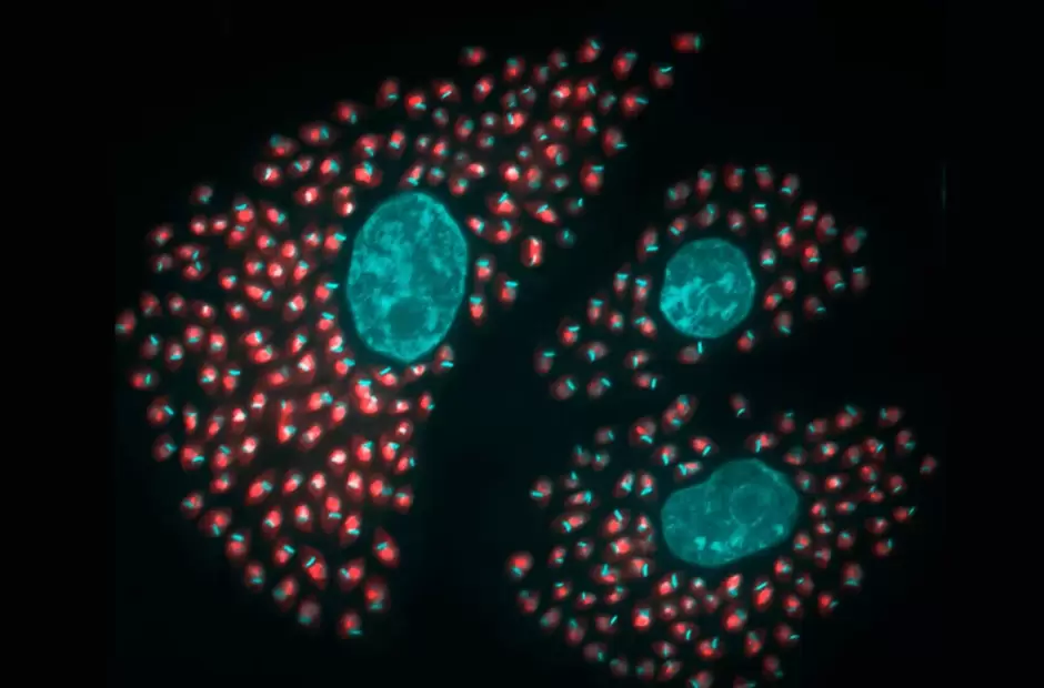 Clulas infectadas con Trypanosoma cruzi