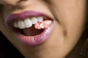 Por qu me molesta tanto que las personas hagan ruidos al masticar?