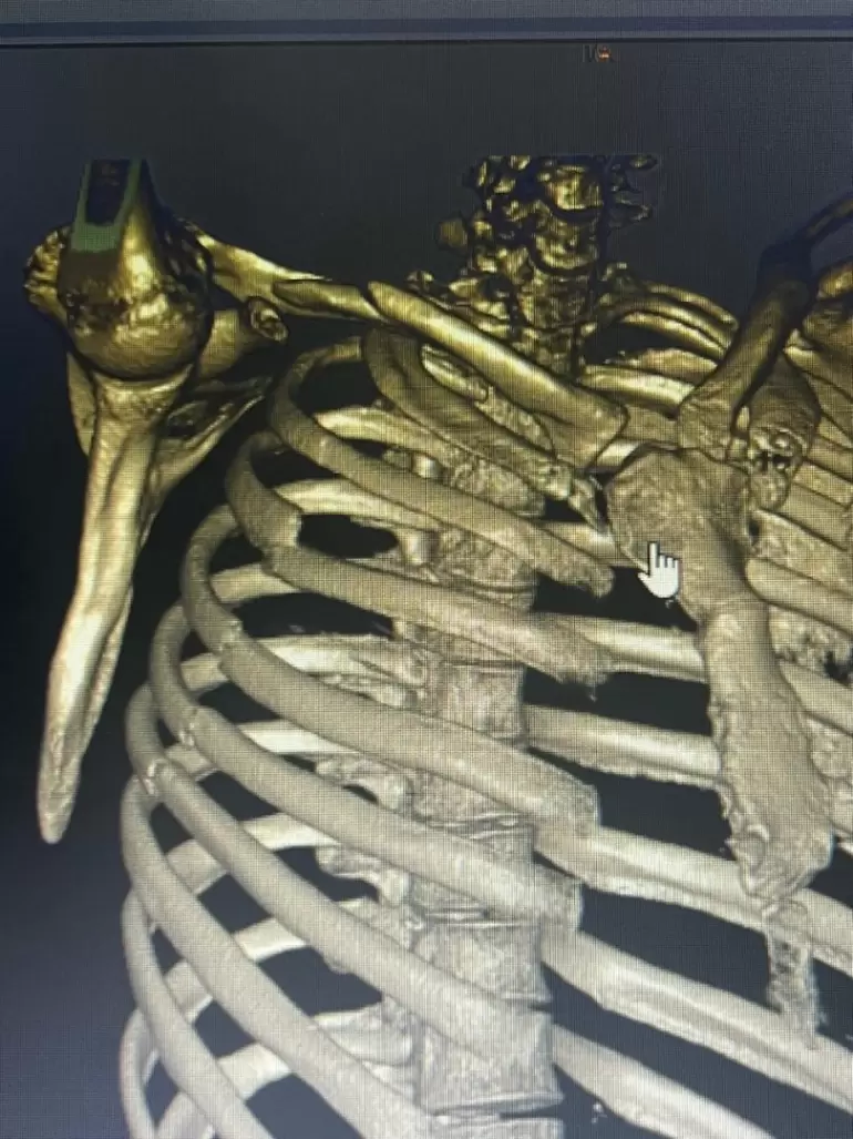 cirugia complejo hsjb