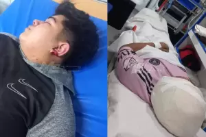 Brutal ataque: le arrancaron un pedazo de oreja de un mordisco a un joven