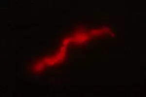 Cient�ficos del CONICET desarrollaron un test r�pido y econ�mico para detectar tuberculosis