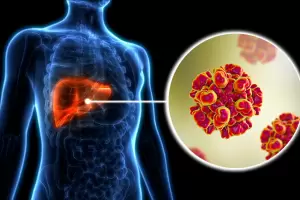 Semana de la Hepatitis: concientizar, detectar y tratar a tiempo