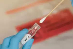 Detectaron en Argentina la variante "Frankenstein" de COVID-19: sntomas y riesgos