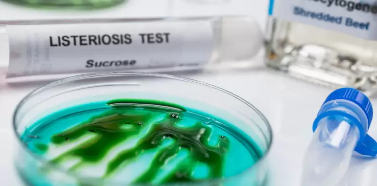 listeriosis alerta sanitaria quesos