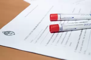 El Gobierno aprob un protocolo para que las fuerzas federales tomen muestras de ADN