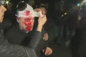 Le partieron la cara a un periodista durante el acto de Javier Milei