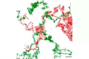 Visualizan por primera vez un neurorreceptor de enfermedades neurolgicas