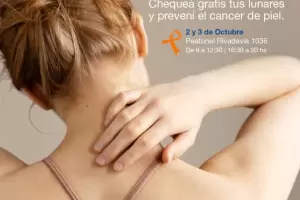 Instalan un consultorio mvil para controlar lunares: los horarios