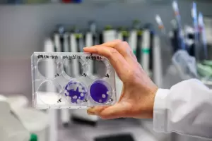 Detectaron los tres primeros casos de la "supergripe" H3N2 en Argentina