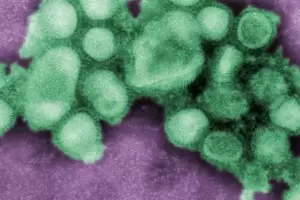 "Supergripe" H3N2 en Argentina: crecen los casos sin antecedente de viaje y se encienden las alertas