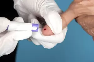 Freno a la prevenci�n: VIH y s�filis avanzan ante el ajuste oficial