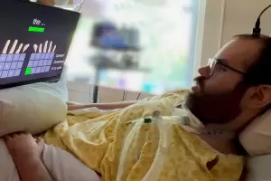 Prueban un innovador dispositivo en pacientes con ELA para que vuelvan a escribir