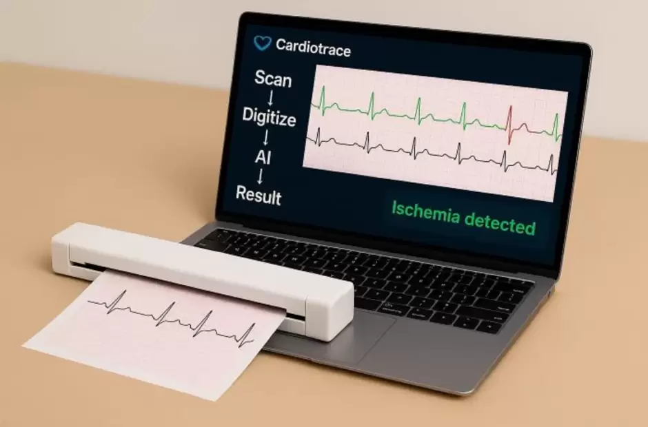Cardiotrace