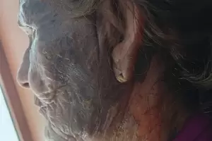 Brutal episodio de violencia en Catamarca: roci� a su vecina de 84 a�os con combustible y la prendi� fuego