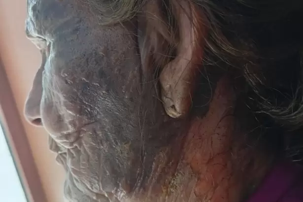 Brutal episodio de violencia: roci� a su vecina con combustible y la prendi� fuego