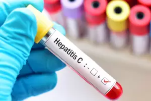 Hepatitis C: 8 de cada 10 personas a�n no se trataron para curarse