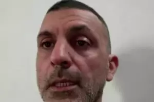 C�ncer de pulm�n: a figura de la TV tambi�n le extirparon un l�bulo y volvi� a trabajar a los diez d�as